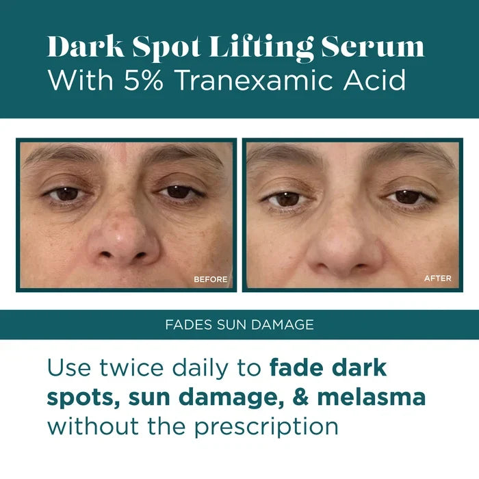 Dark Spot Lifting Serum with 5% Tranexamic Acid 1.7 oz