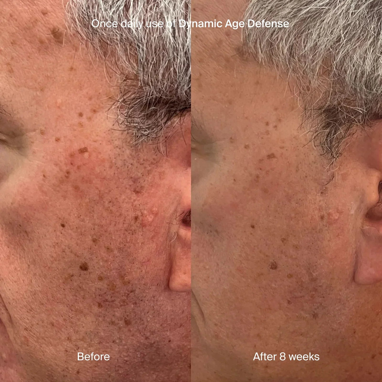 Dynamic Age Defense SPF30
