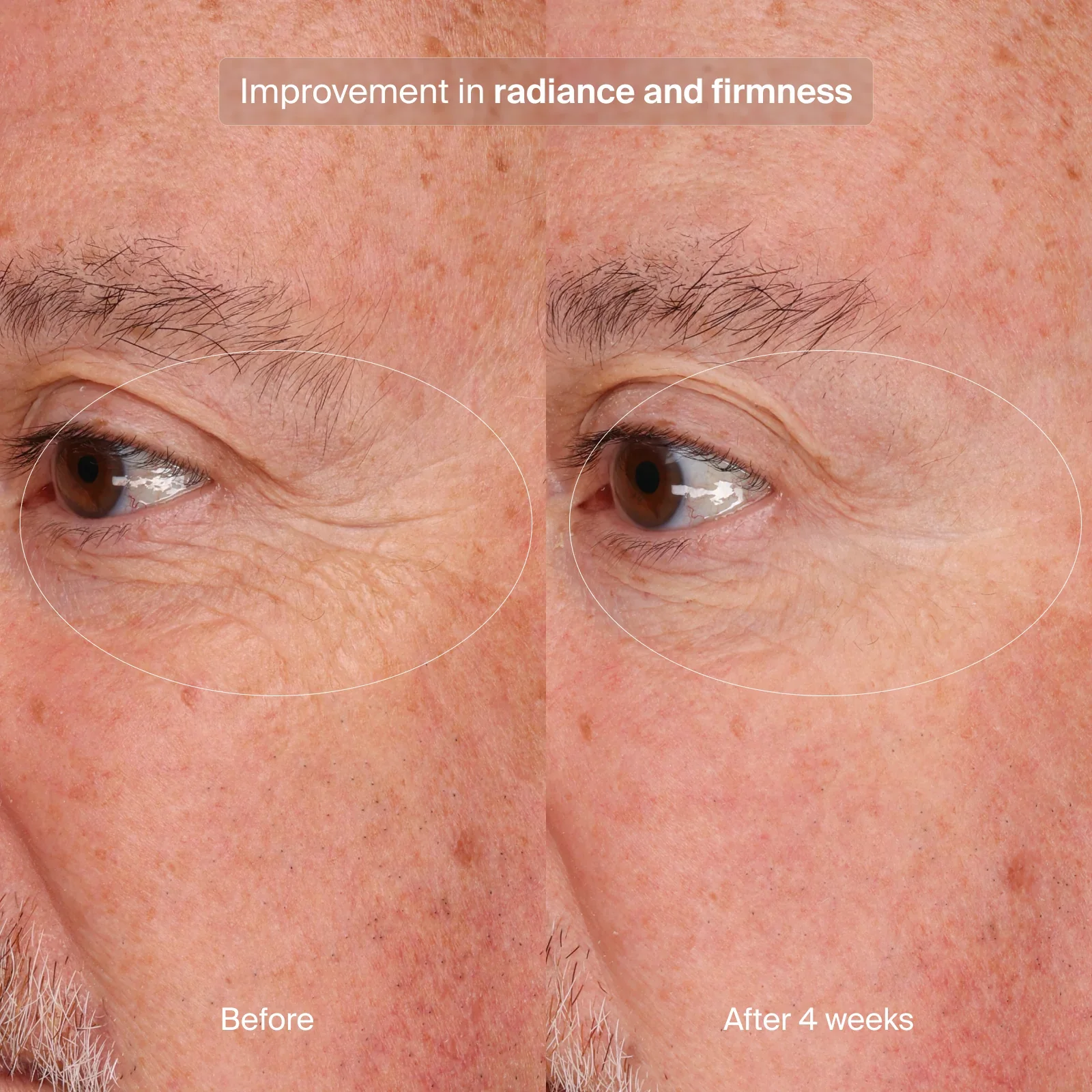 Precision Eye Lift 0.5 oz