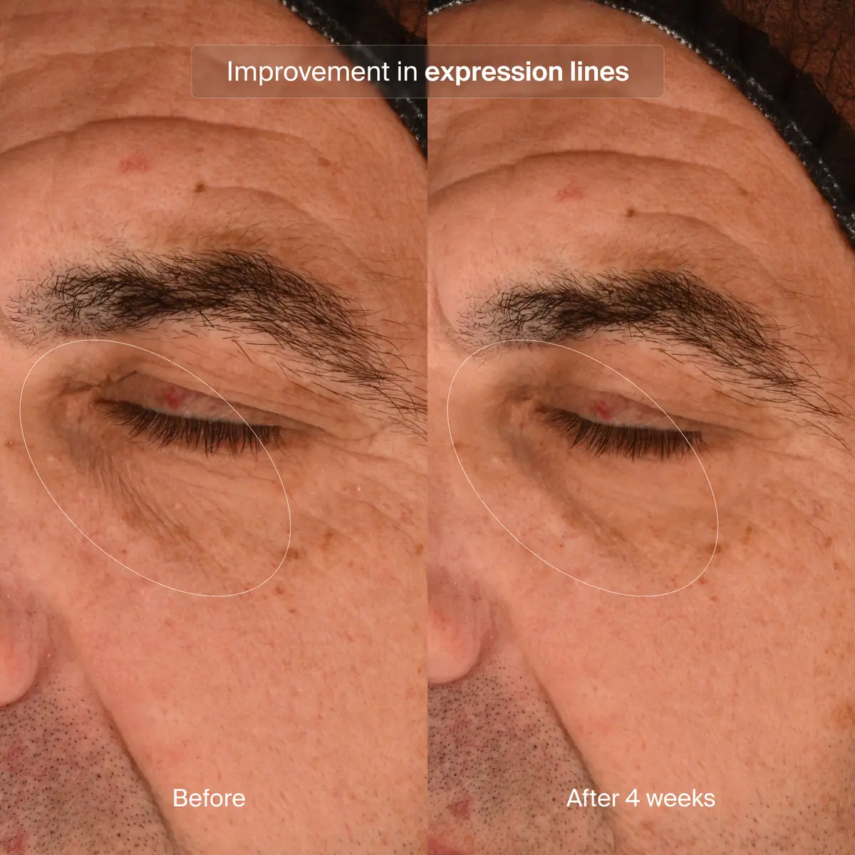 Precision Eye Lift 0.5 oz