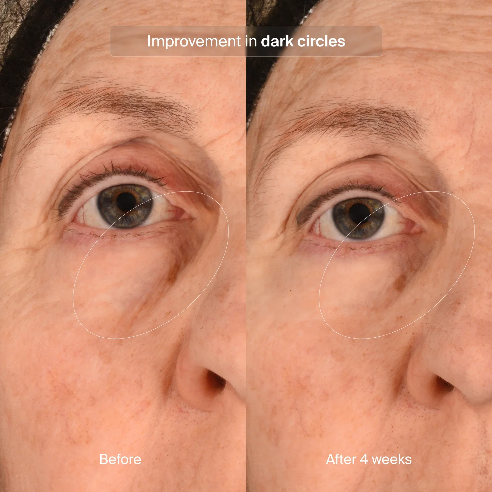 Precision Eye Lift 0.5 oz