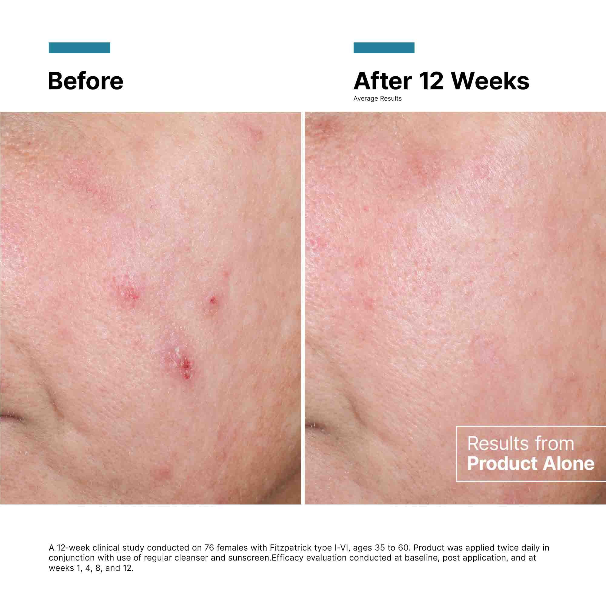 Advanced RGN-6 Skin Regeneration Cream 1.7 oz