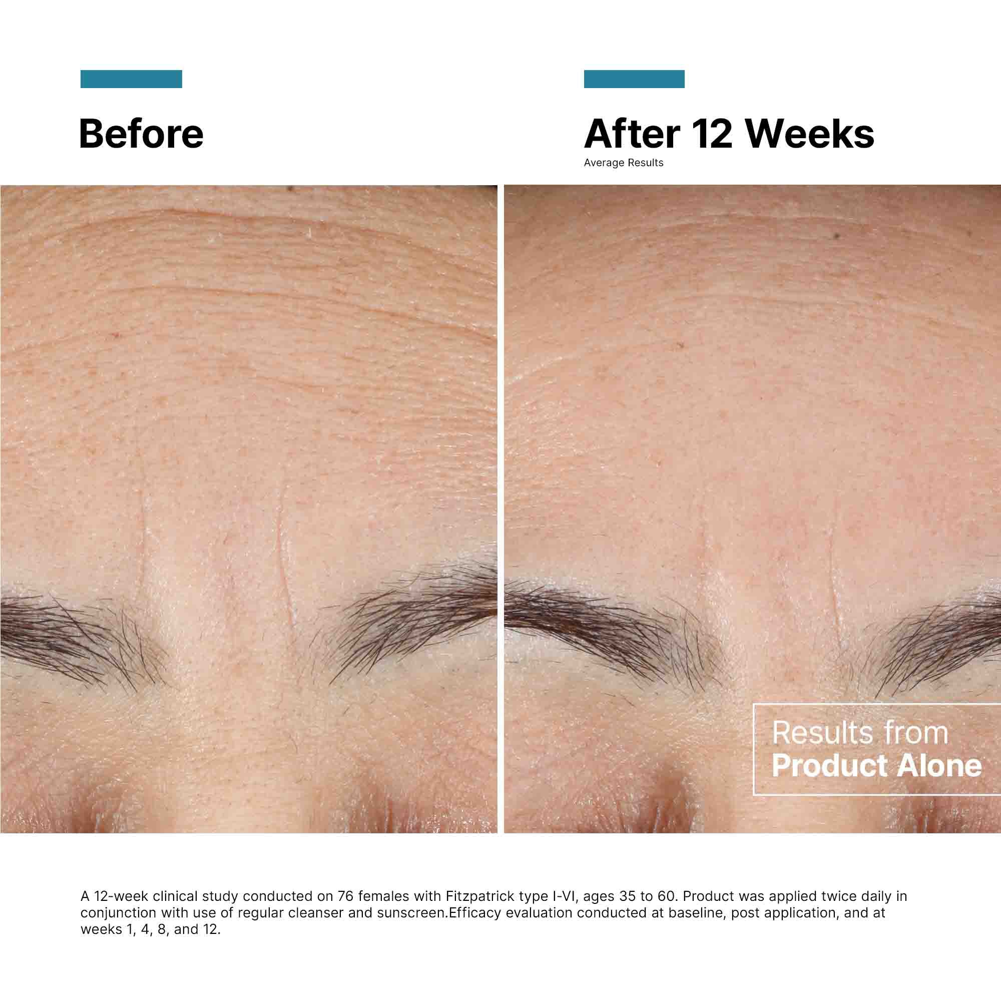 Advanced RGN-6 Skin Regeneration Cream 1.7 oz