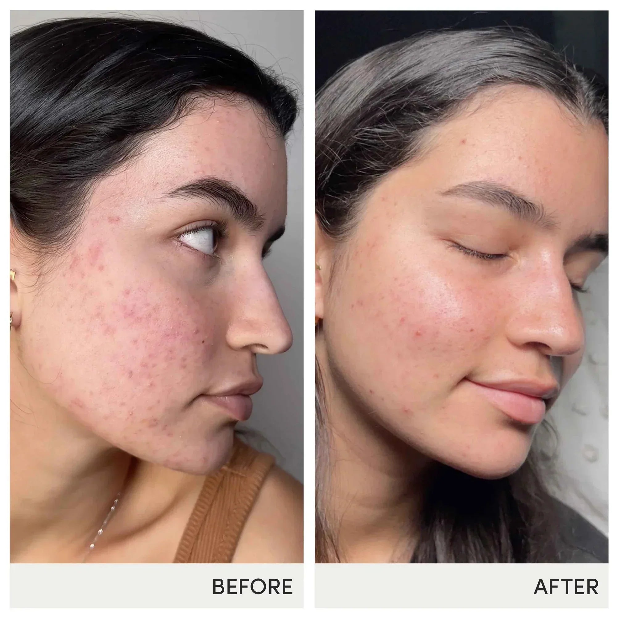 Skin Accumax 180 ct