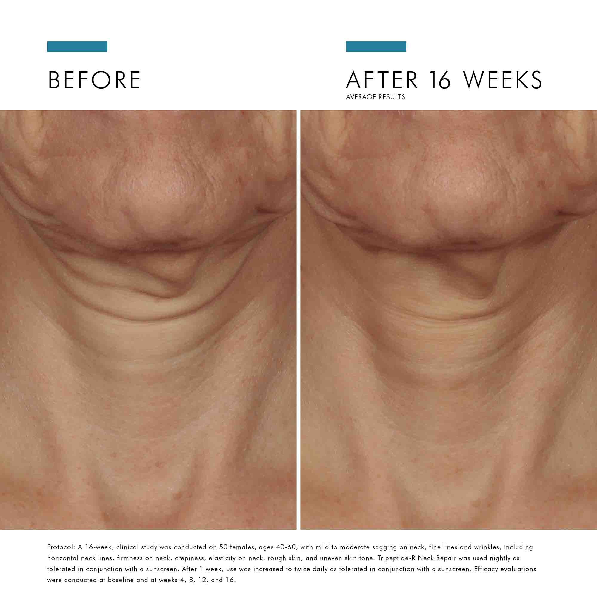 Tripeptide-R Neck Repair 1.7 oz