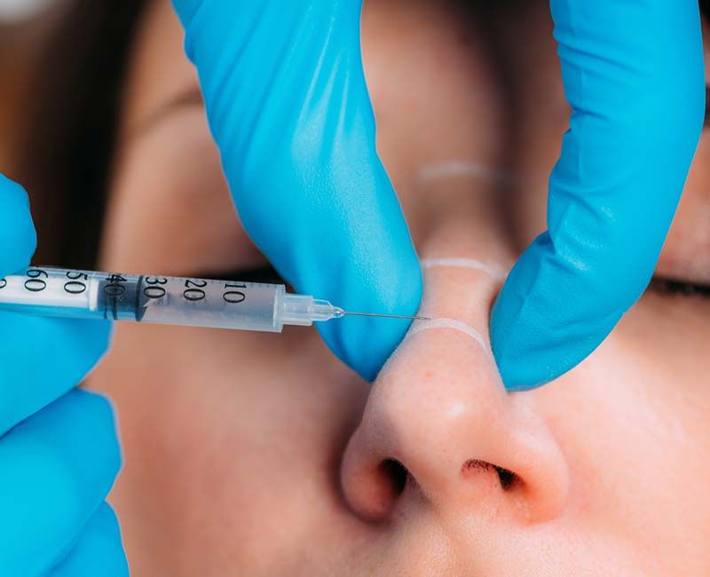 Liquid Rhinoplasty