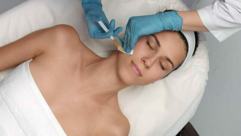 PRP Facial